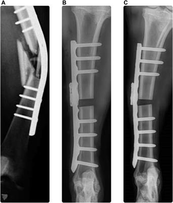 On the importance of accurate elasto-plastic material properties in simulating plate osteosynthesis failure